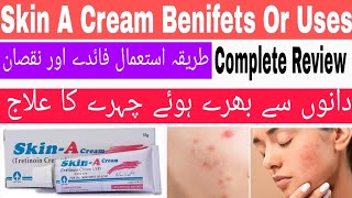 Skin-A cream Uses and side effects review | Tretenoin 0.05 % cream review | Skin A cream benefits