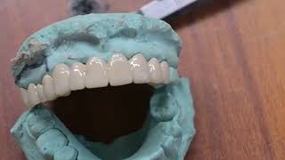 pfm 🦷 tooth #video