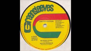 ReGGae Music 781 - Keith Hudson - Bloody Eyes [Greensleeves]