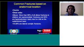 E-class: Common Pediatric Fractures by Dr Monika Sharma, Consultant Radiologist.