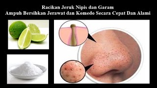 Menghilangkan Jerawat dan Komedo Secara Cepat dan Alami