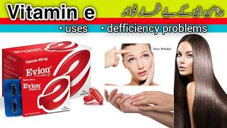 vitamin e capsules for skin|vitamin e capsule ke fayde|vitamin e uses|medical knowledge pk