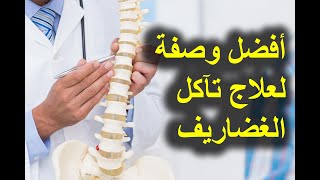 أفضل وصفتين لعلاج مشكلة تأكل الغضاريف وألام الظهر وخشونة الركبة