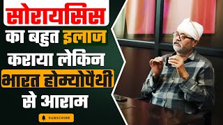 कुछ ही दिनों में सोरायसिस से आराम  |  Psoriasis Cure | Psoriasis Recovery