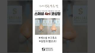 [성형전후] 재수술 구축코 들창코(짧은코) #shorts