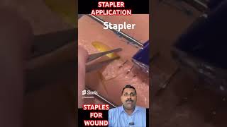 Stapler