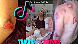 Hey Yo Something Traumatic Happened and Changed My Life Check |TikTok Compilation