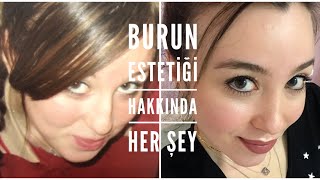 BURUN AMELİYATIM HAKKINDA HER ŞEY!