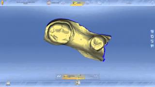 CEREC GUIDE 2, IMPLANT PLANNING