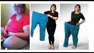 Vanessa Describes the Pain of Obesity and the Decision to Take Control