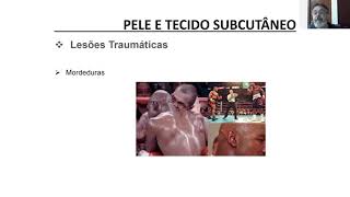 Pele e Tecido Subcutâneo