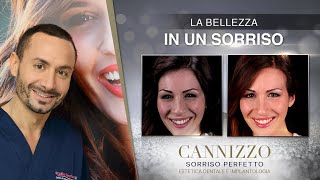 La bellezza In Un Sorriso Perfetto - Studio Cannizzo