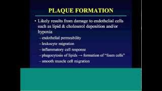 Plaque formation - Carotid Plaque by Prof. Leslie Scoutt