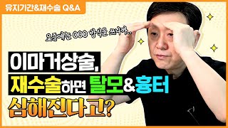 ※이마거상술 Q&A※이마거상 평생 유지되나요? 재수술하면 탈모랑 흉터 더 심해지나요?  -의학박사 백승준