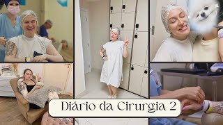 DIÁRIO DA CIRURGIA PLÁSTICA 2: O que eu fiz e 2 dias de Pós operatório! Duda Fernandes