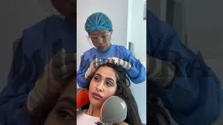 احمي شعرك من التساقط #زراعة_الشعر #زراعةالشعر #قبل_وبعد #الامارات #دبي