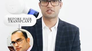 Hair Transplant surgery testimonial - Padra Medical Center DXB