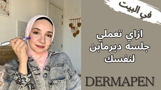 عملت لنفسي جلسه ديرمابن في البيت || Dermapen session at home