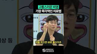 비염 빨리 고치는 방법