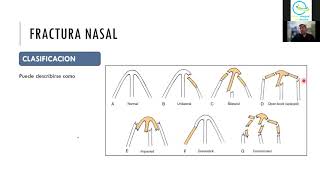 CURSO URGENCIAS OTORRINOLARINGOLOGICAS