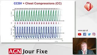 Die CCSV- Beatmung - Prof. Dr. Clemens Kill