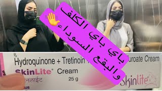 شاركت معاكم كريم المعجزة للتخلص من #الكلف# و#البقع السوداء# خريجة انا وصحبتي لسينما😎