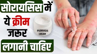 Psoriasis Patients कौन सी क्रीम लगा सकते है? | Best Cream For Psoriasis Patients | Bharat Homeo