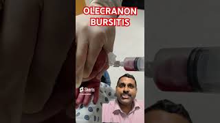 OLECRANON BURSITIS