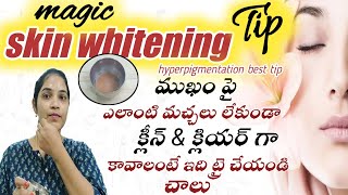 How To Remove Pigmentation Home Remedy in Telugu/skin whitening home remedy/ trendy ramya ideas