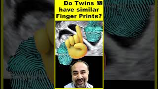 Do Twins have similar Finger Prints?  #facts #hindi #sciencefacts