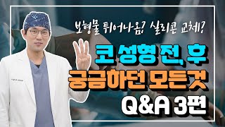 [코성형 Q&A 3편]나중에 실리콘 보형물이 튀어나오나요?실리콘 보형물을 주기적으로 교체해주어야 하나요?