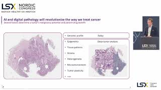 AI and digital pathology will revolutionize the way we treat cancer - Histotype Px®