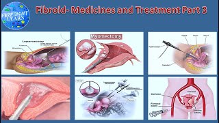 Fibroid  Treatment , Medicines Part 3