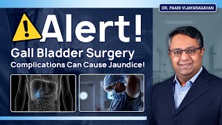 Alert! Gall Bladder Surgery Complications Can Cause Jaundice!