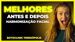 NOSSOS ANTES E DEPOIS MARAVILHOSOS