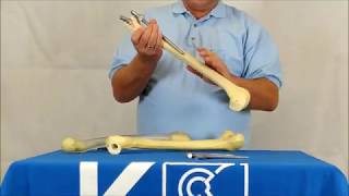 Spiron Hip Prosthesis: General Information pt. 2 | K-implant Info Channel