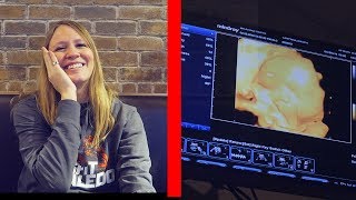 WE GET TO SEE THE BABY’S FACE! 4D scan.(He has Jesse's nose!)