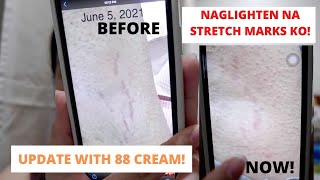 Daily Day Off Vlog.05 | STRETCH MARK UPDATE