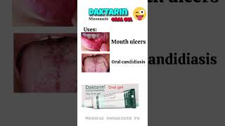 mouth ulcer,oral candidiasis treatment|daktarin oral gel uses||medical knowledge pk