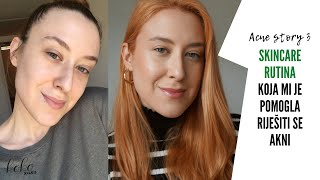 Ovo je SKINCARE RUTINA koja mi je pomogla RIJEŠITI SE (hormonalnih) AKNI!/acne story 3 ~ Koko