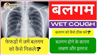 WET COUGH / Post Nasal Drip? बलगम होने के कारण लक्षण और इलाज? बलगम को कैसे ठीक करें?