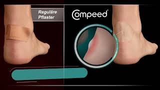 Compeed® Blasenpflaster - und weiter geht's!