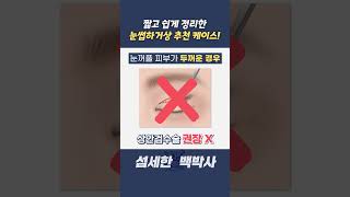 피부 처짐 때문에 고민 중이라면? '이 수술'로 10년 젊어지자! #shorts