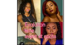 Évolution Anie avant et après