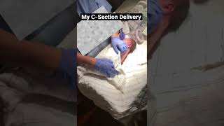 A glimpse of my C-section delivery #C-section #Cesarean #SurgeryRoom #Postop #LaborAndDelivery