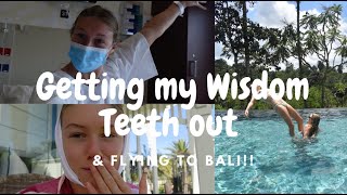 I got my wisdom teeth out and then flew to Bali | VLOG