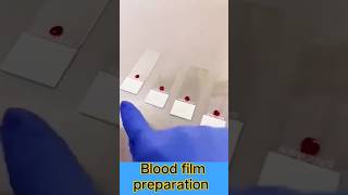 blood film preparation #microscope #mltclasses #dmlt #bacteria #dmlt #biology #microscopics