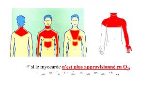 Les insuffisances coronariennes