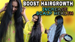 🤩விறு விறுனு வேகமாக Smooth and silky முடி வளரனுமா?? Control dryness||itchy scalp