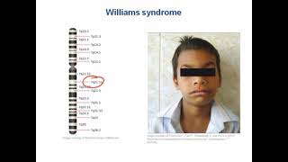 Williams syndrome